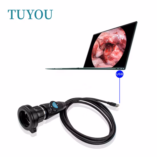 Portable Medical Capsule Endoscope Inspection USB Camera for Ent Endoscopy
